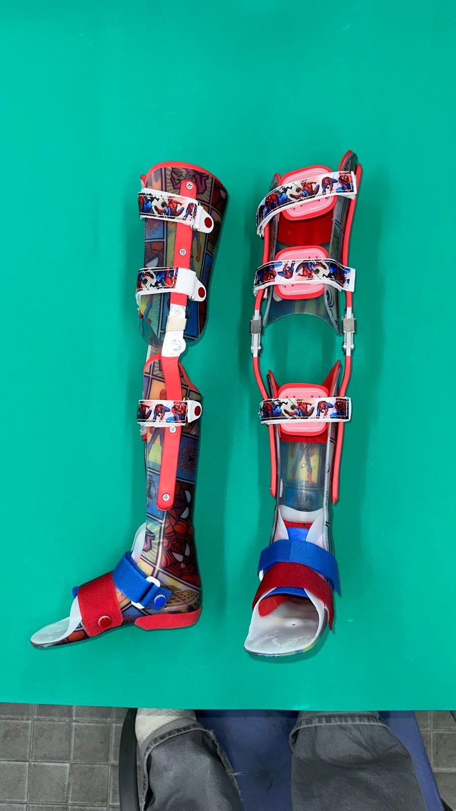 Bitutor femoral - Imagen 3