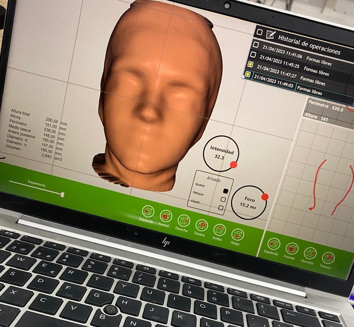 Aparells d’ortesis a mida